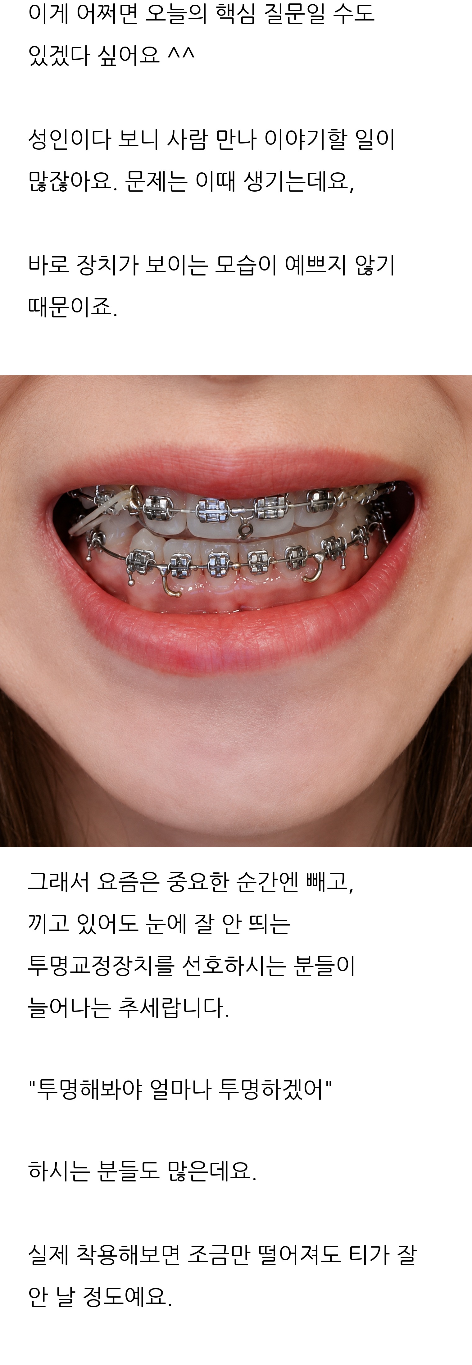 대구 달서구 교정치과 로즈치과교정과치과의원 8