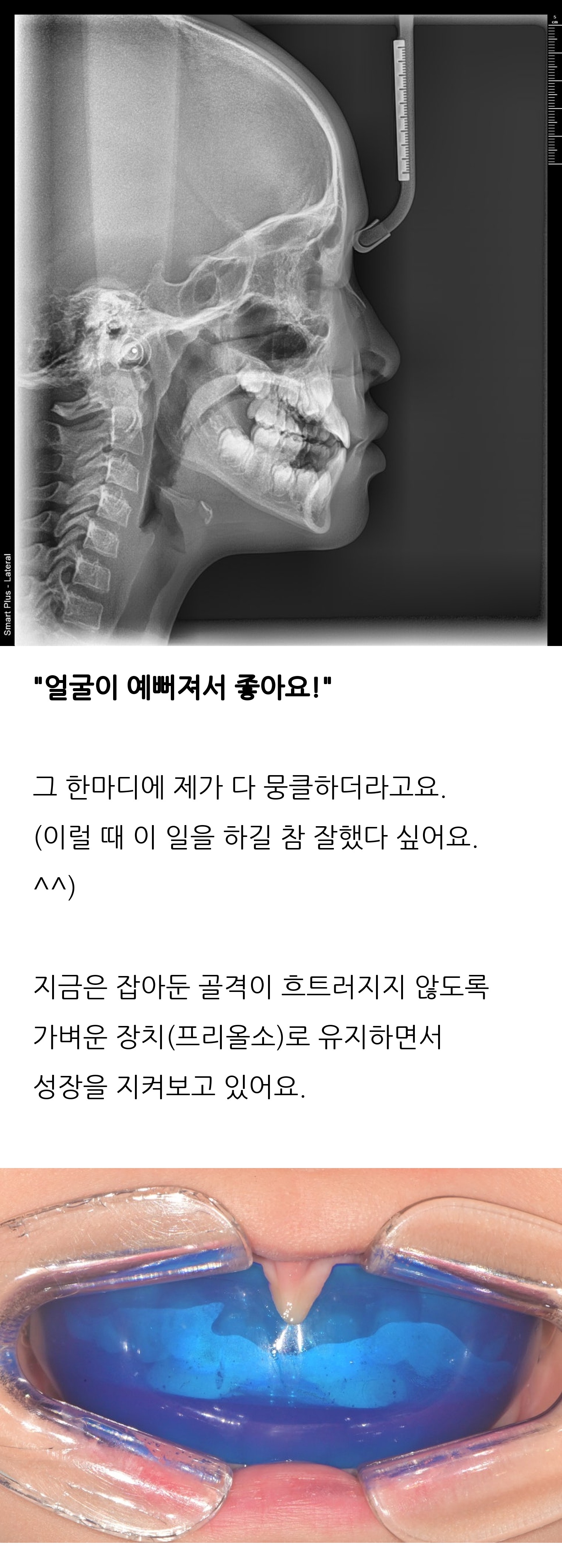 대구 달서구 교정치과 로즈치과교정과치과의원 10
