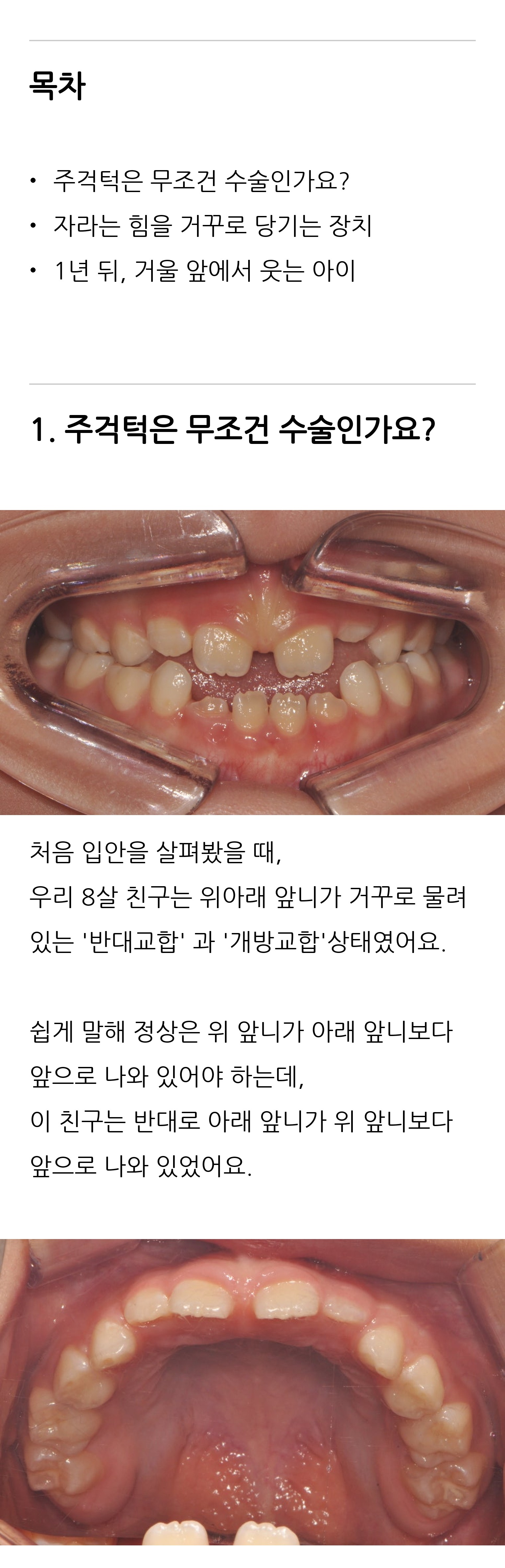 대구 달서구 교정치과 로즈치과교정과치과의원 3