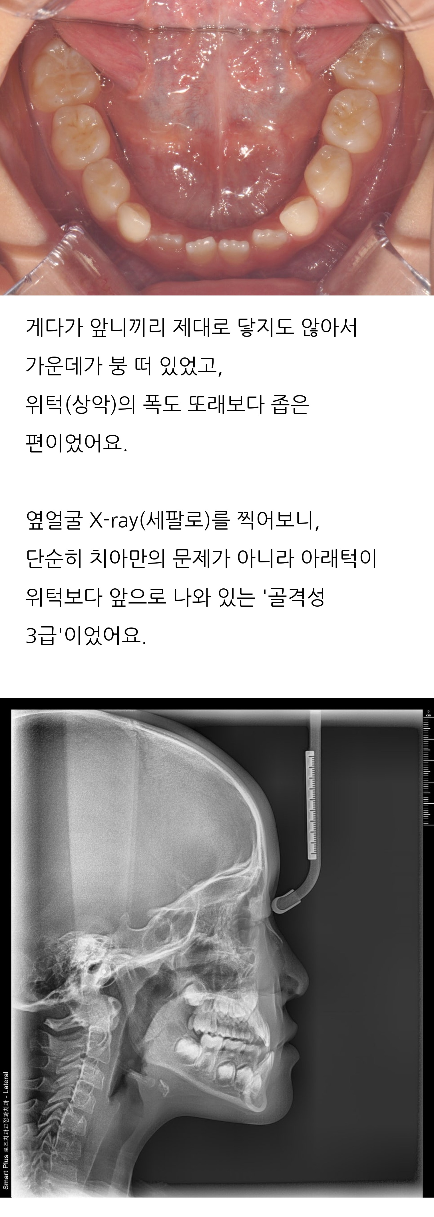 대구 달서구 교정치과 로즈치과교정과치과의원 4