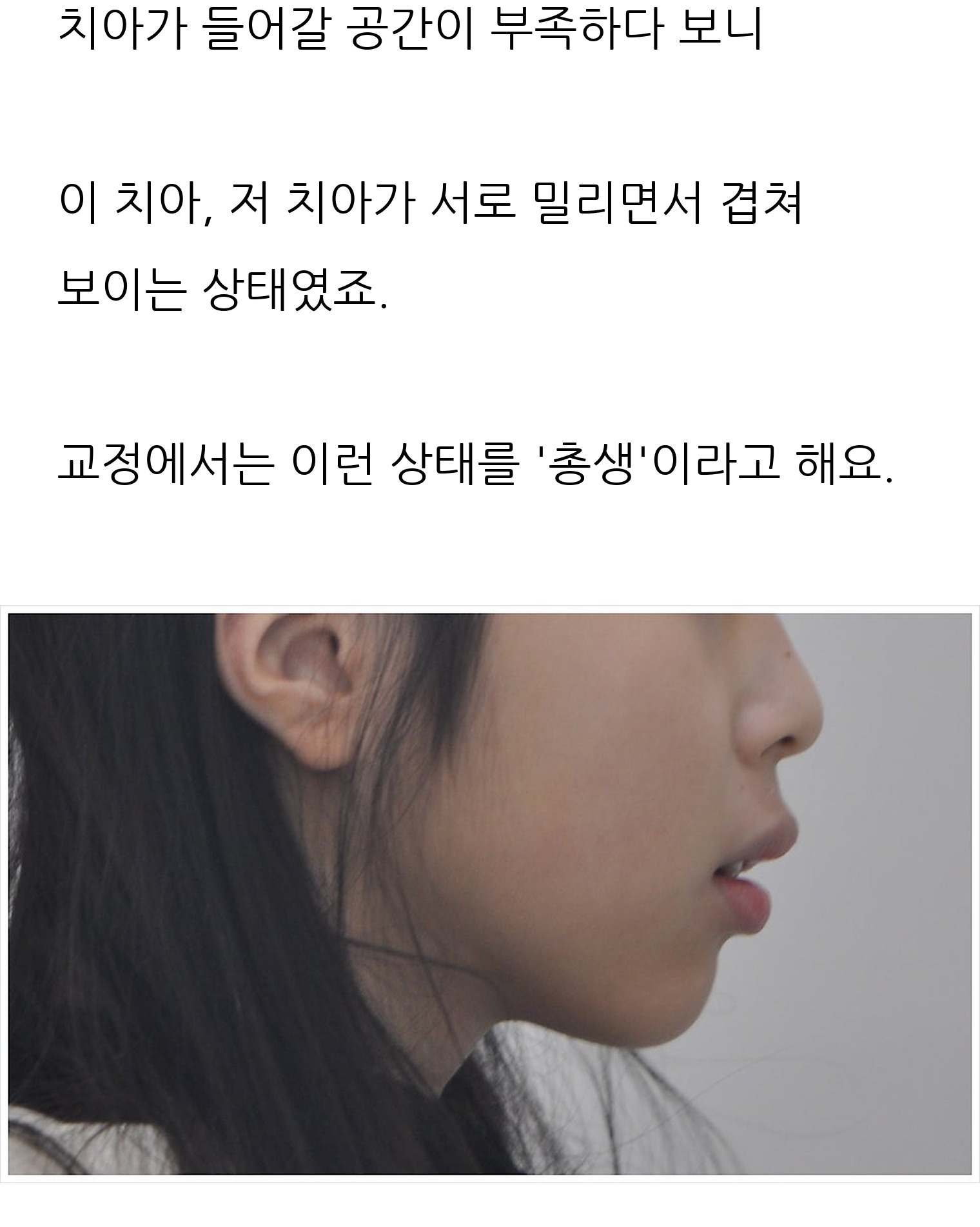 대구 달서구 교정치과 로즈치과교정과치과의원 4