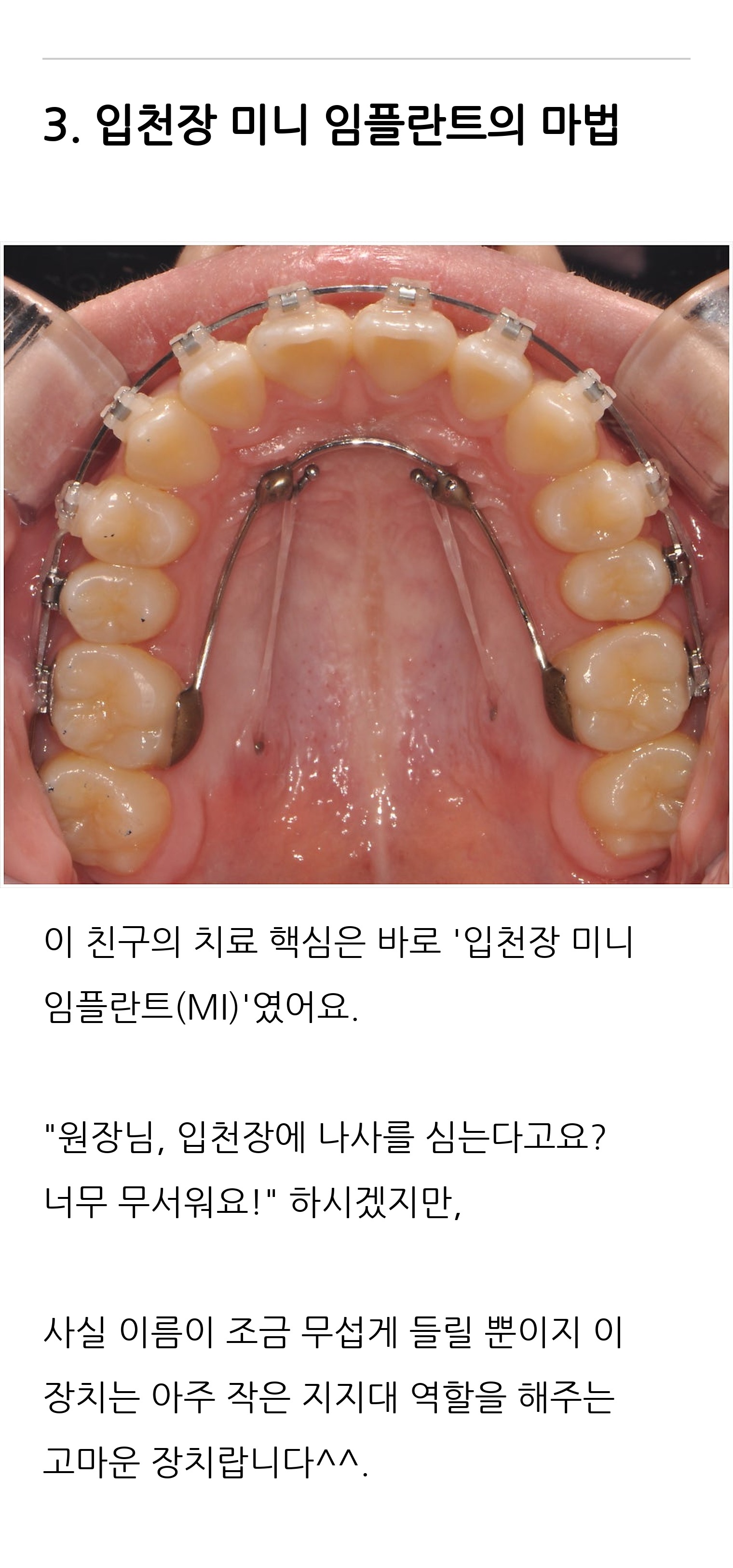 대구 달서구 교정치과 로즈치과교정과치과의원 8