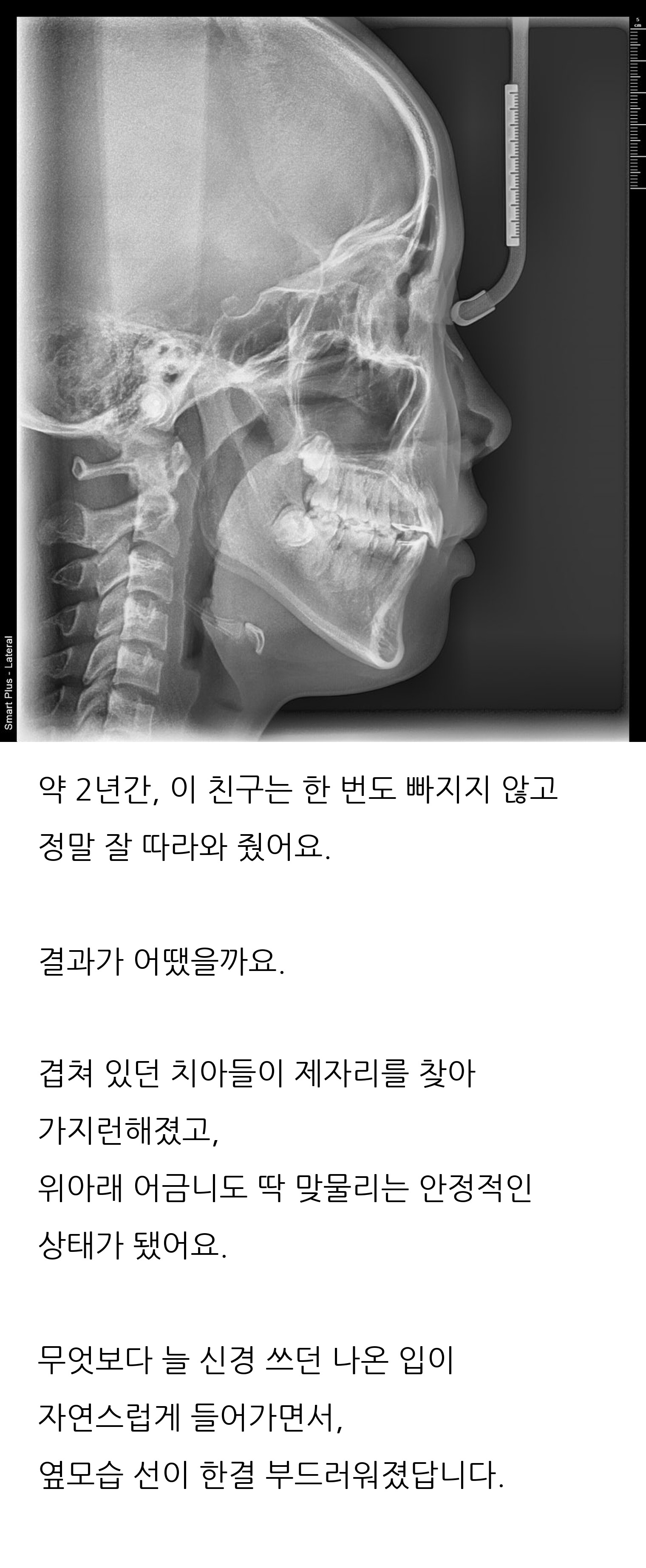 대구 달서구 교정치과 로즈치과교정과치과의원 10