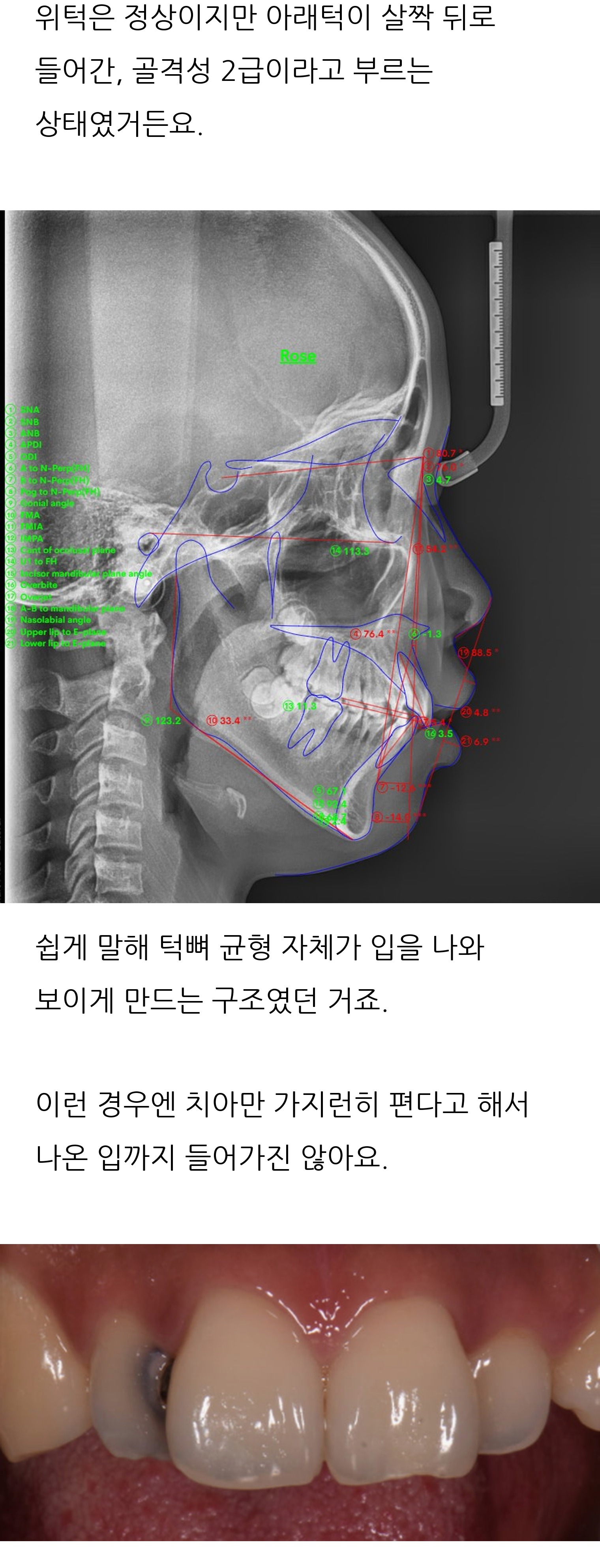 대구 달서구 교정치과 로즈치과교정과치과의원 4