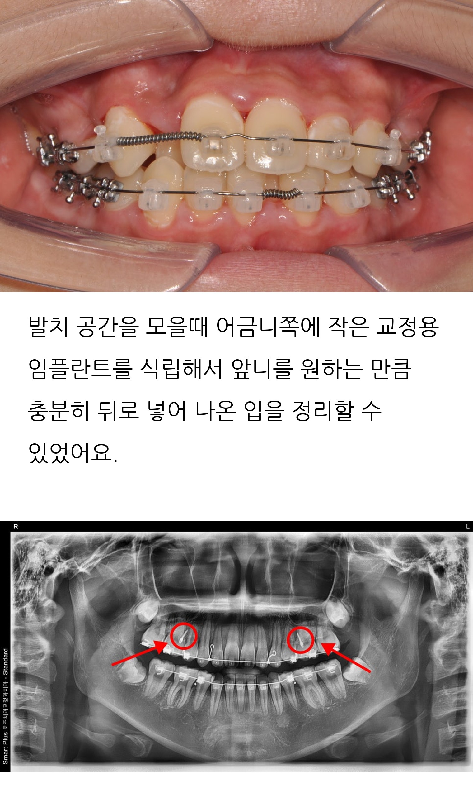 대구 달서구 교정치과 로즈치과교정과치과의원 8